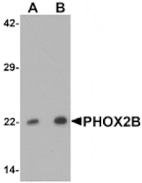 Western blot - PHOX2B Antibody from Signalway Antibody (25435) - Antibodies.com