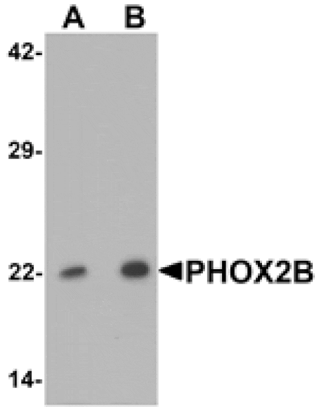Western blot - PHOX2B Antibody from Signalway Antibody (25435) - Antibodies.com