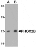 Western blot - PHOX2B Antibody from Signalway Antibody (25435) - Antibodies.com