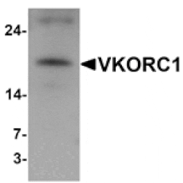 Western blot - VKORC1 Antibody from Signalway Antibody (25474) - Antibodies.com