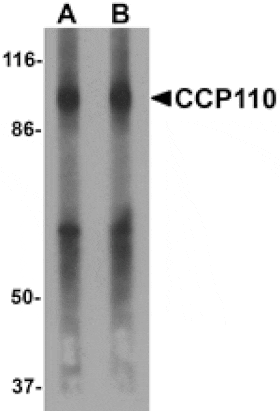 Western blot - CCP110 Antibody from Signalway Antibody (25483) - Antibodies.com