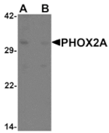Western blot - PHOX2A Antibody from Signalway Antibody (25484) - Antibodies.com