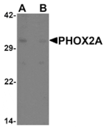 Western blot - PHOX2A Antibody from Signalway Antibody (25484) - Antibodies.com