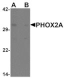 Western blot - PHOX2A Antibody from Signalway Antibody (25484) - Antibodies.com