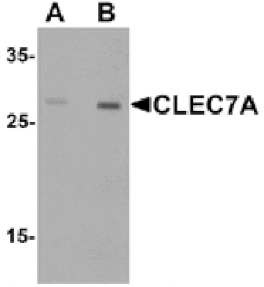 Western blot - CLEC7A Antibody from Signalway Antibody (25485) - Antibodies.com