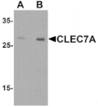 Western blot - CLEC7A Antibody from Signalway Antibody (25485) - Antibodies.com