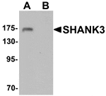 Western blot analysis of SHANK3 in 3T3 cell lysate with SHANK3 antibody at 1 µg/mL in (A) the absence and (B) the presence of blocking peptide.