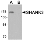 Western blot - SHANK3 Antibody from Signalway Antibody (25486) - Antibodies.com