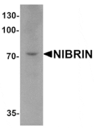 Western blot - NIBRIN Antibody from Signalway Antibody (25487) - Antibodies.com