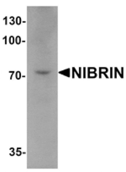 Western blot - NIBRIN Antibody from Signalway Antibody (25487) - Antibodies.com