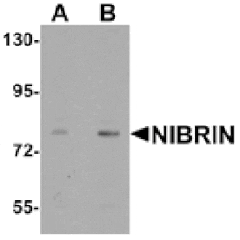 Western blot - NIBRIN Antibody from Signalway Antibody (25488) - Antibodies.com