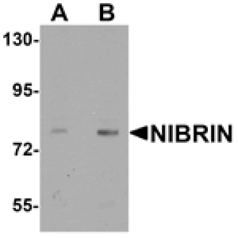 Western blot - NIBRIN Antibody from Signalway Antibody (25488) - Antibodies.com