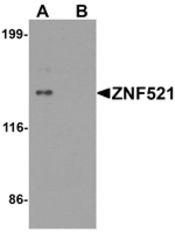 Western blot - ZNF521 Antibody from Signalway Antibody (25491) - Antibodies.com