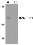 Western blot - ZNF521 Antibody from Signalway Antibody (25491) - Antibodies.com