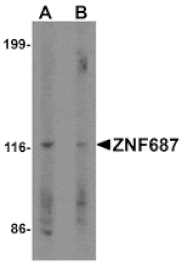 Western blot - ZNF687 Antibody from Signalway Antibody (25492) - Antibodies.com