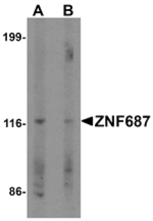 Western blot - ZNF687 Antibody from Signalway Antibody (25492) - Antibodies.com