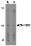 Western blot - ZNF687 Antibody from Signalway Antibody (25492) - Antibodies.com