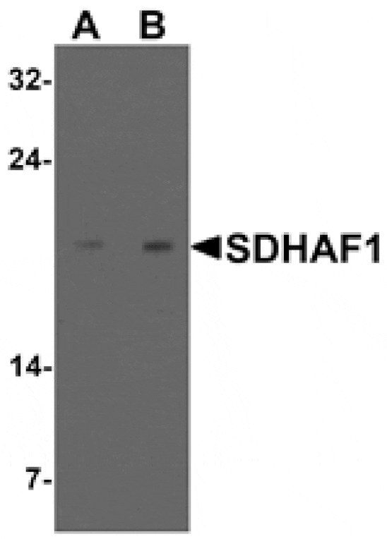 Western blot - SDHAF1 Antibody from Signalway Antibody (25496) - Antibodies.com
