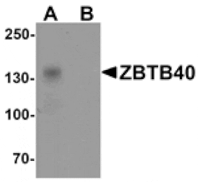 Western blot - ZBTB40 Antibody from Signalway Antibody (25503) - Antibodies.com