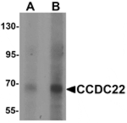 Western blot - CCDC22 Antibody from Signalway Antibody (25513) - Antibodies.com
