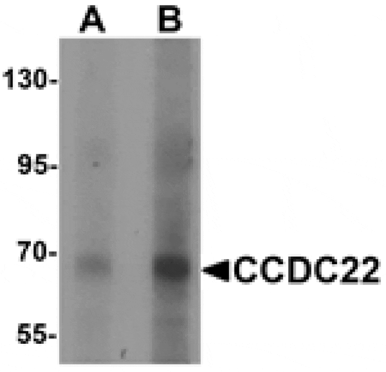 Western blot - CCDC22 Antibody from Signalway Antibody (25513) - Antibodies.com