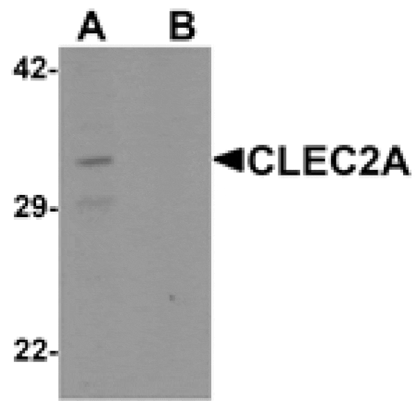 Western blot - CLEC2A Antibody from Signalway Antibody (25515) - Antibodies.com