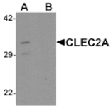 Western blot - CLEC2A Antibody from Signalway Antibody (25515) - Antibodies.com