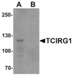 Western blot - TCIRG1 Antibody from Signalway Antibody (25518) - Antibodies.com