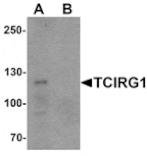 Western blot - TCIRG1 Antibody from Signalway Antibody (25518) - Antibodies.com