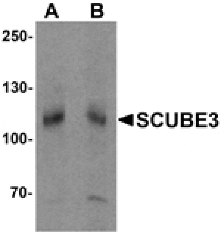 Western blot - SCUBE3 Antibody from Signalway Antibody (25528) - Antibodies.com