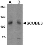 Western blot - SCUBE3 Antibody from Signalway Antibody (25528) - Antibodies.com