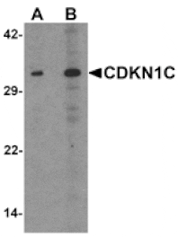 Western blot - CDKN1C Antibody from Signalway Antibody (25533) - Antibodies.com