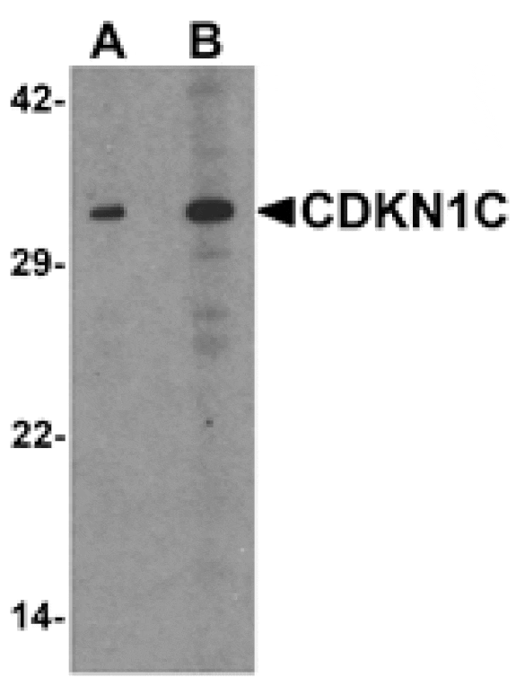 Western blot - CDKN1C Antibody from Signalway Antibody (25533) - Antibodies.com