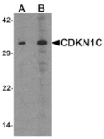 Western blot - CDKN1C Antibody from Signalway Antibody (25533) - Antibodies.com
