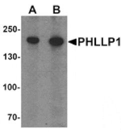 Western blot - PHLPP1 Antibody from Signalway Antibody (25535) - Antibodies.com