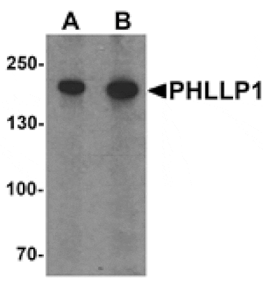 Western blot - PHLPP1 Antibody from Signalway Antibody (25535) - Antibodies.com