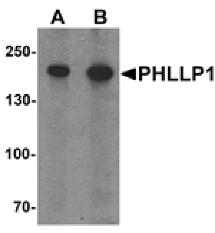 Western blot - PHLPP1 Antibody from Signalway Antibody (25535) - Antibodies.com