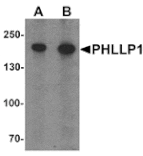 Western blot - PHLPP1 Antibody from Signalway Antibody (25535) - Antibodies.com