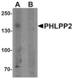 Western blot - PHLPP2 Antibody from Signalway Antibody (25536) - Antibodies.com