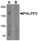 Western blot - PHLPP2 Antibody from Signalway Antibody (25536) - Antibodies.com