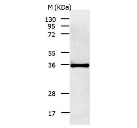 IL11RA Antibody from Signalway Antibody (31020) - Antibodies.com