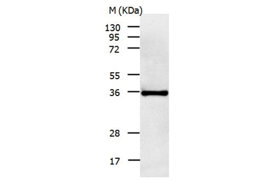 IL11RA Antibody from Signalway Antibody (31020) - Antibodies.com