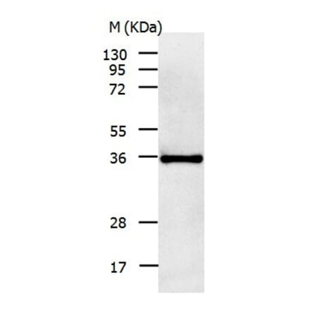 IL11RA Antibody from Signalway Antibody (31020) - Antibodies.com
