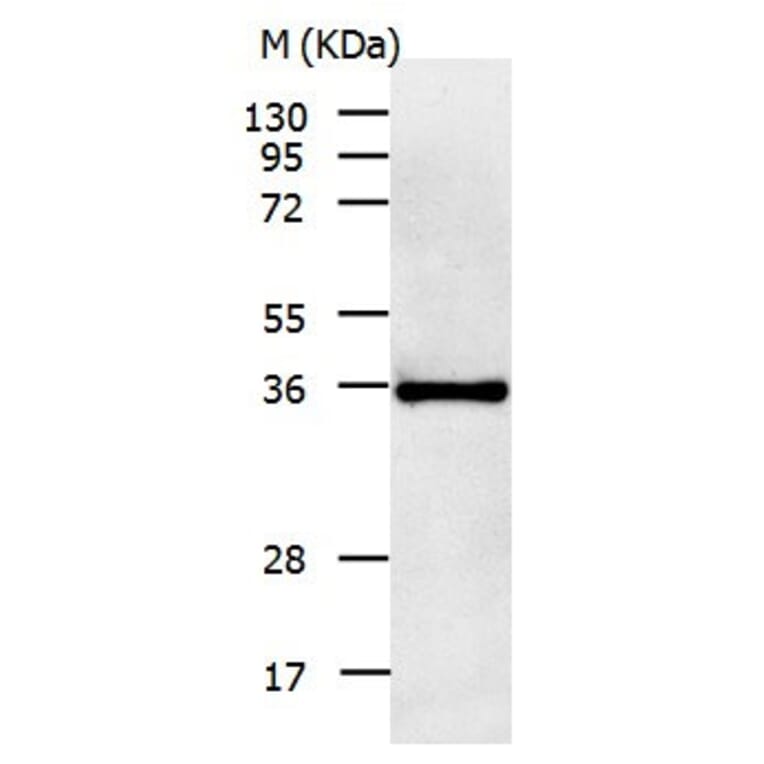 IL11RA Antibody from Signalway Antibody (31020) - Antibodies.com
