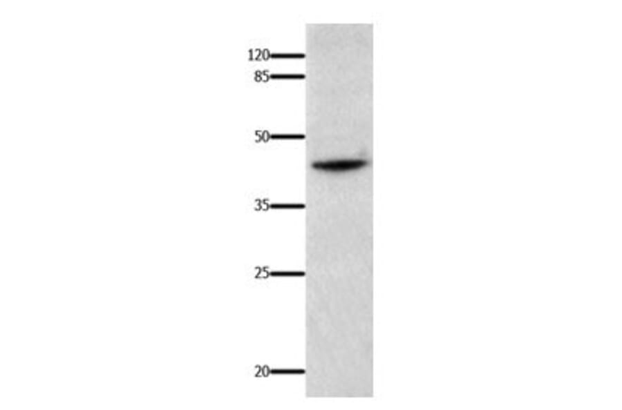 IL18BP Antibody from Signalway Antibody (31022) - Antibodies.com