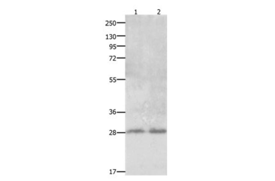 CLEC1A Antibody from Signalway Antibody (31058) - Antibodies.com