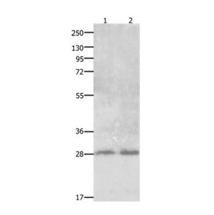 CLEC1A Antibody from Signalway Antibody (31058) - Antibodies.com