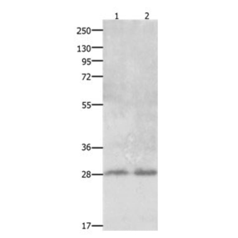CLEC1A Antibody from Signalway Antibody (31058) - Antibodies.com