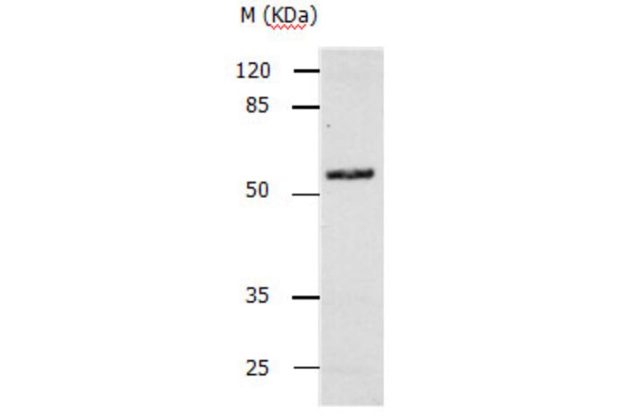 CASP10 Antibody from Signalway Antibody (31137) - Antibodies.com