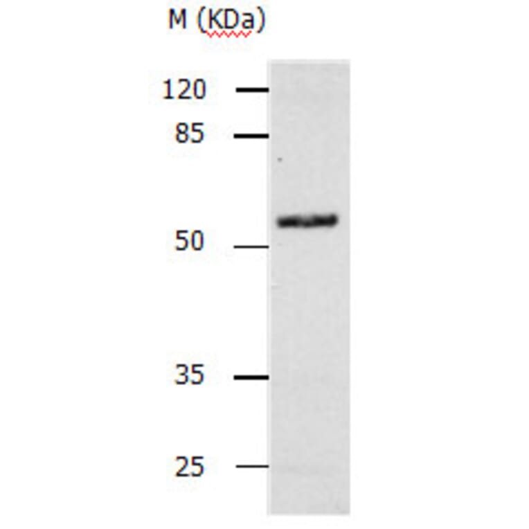 CASP10 Antibody from Signalway Antibody (31137) - Antibodies.com